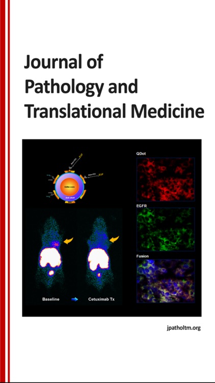 Journal of Pathology and Translational Medicine for iPhone