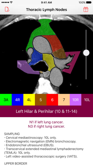 Thoracic Lymph Node Map(圖4)-速報App