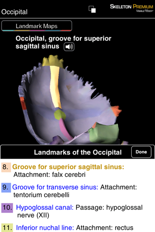 Skeleton Premium for Springer (Skelet Premie voor Springer) screenshot 4