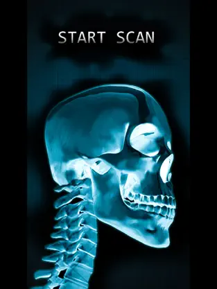 Captura de Pantalla 2 Simulator X-Ray Bone Fake iphone