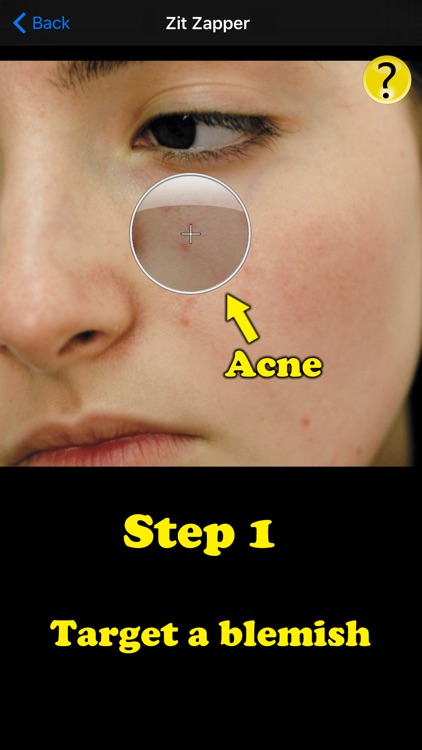 Zit Zapper Pro - Airbrush your face and remove pimples and acne