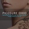 Picosure Ohio