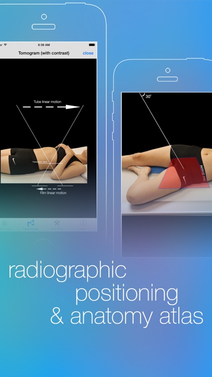 iRad Xrays