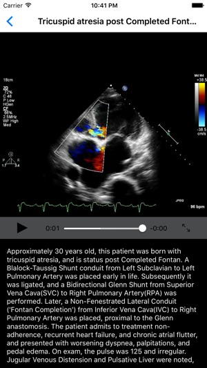 CARDIO3® Comprehensive Atlas of Echocardiography - Lite(圖4)-速報App