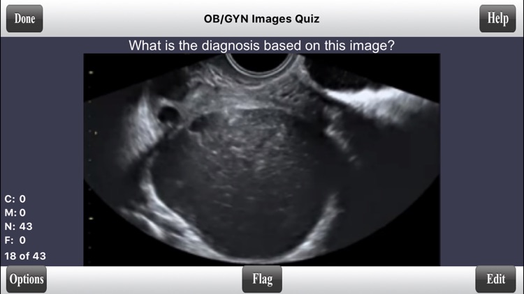 ARRT Sonography (Ultrasound) Flashcards Lite