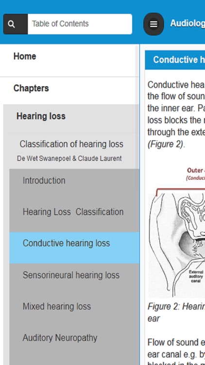 Audiology and Hearing Aids for Otolaryngologist