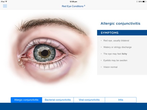 Aspen Eye screenshot 3
