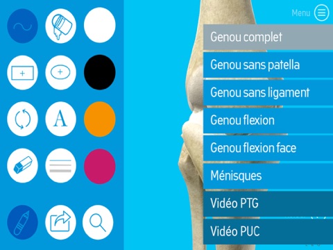 Screenshot #4 pour Orthoblok