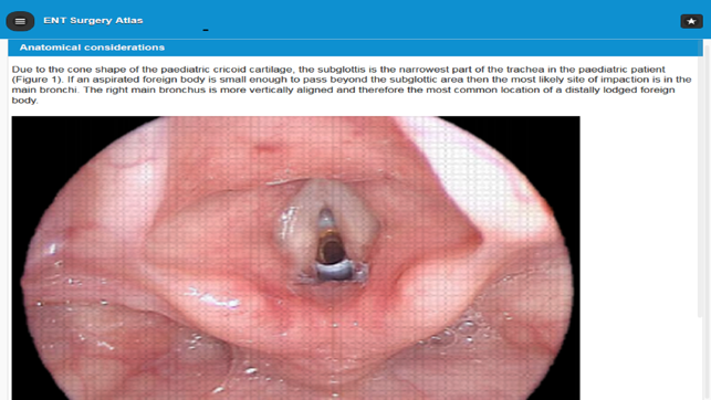 ENT Surgery Atlas(圖4)-速報App