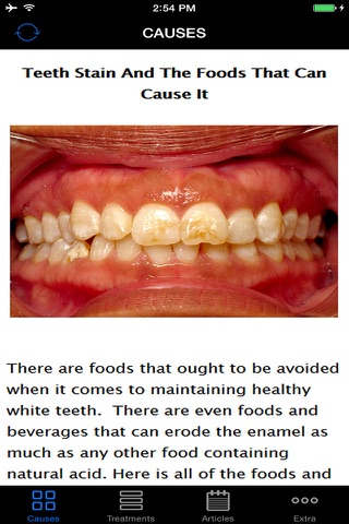Best Natural Way To Whiten Teeth - Home Remedies Guide & Tips For Beginners, Save Money! screenshot 2