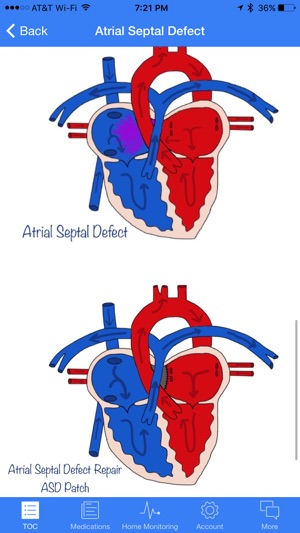 Smart Heart DC(圖3)-速報App