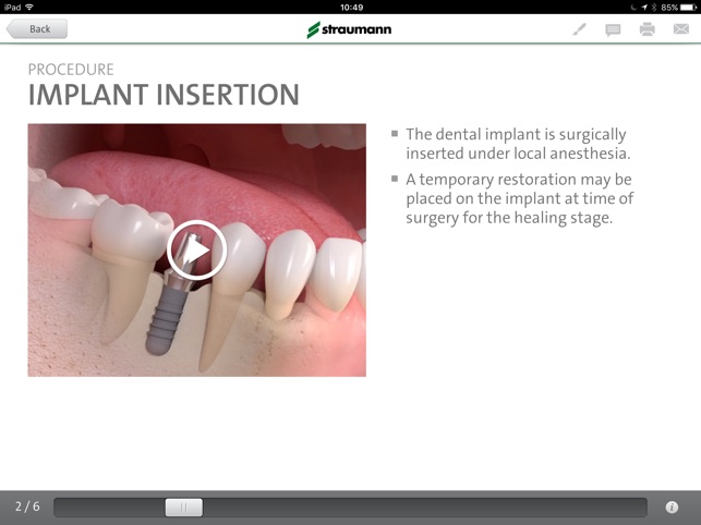 Straumann® Patient Education App