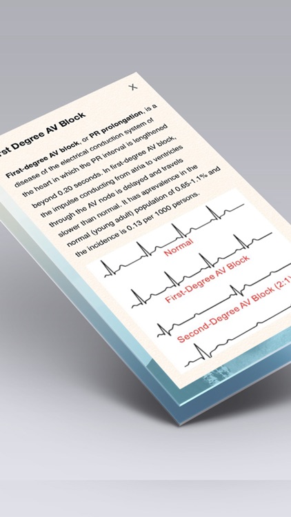 ECG Books Pro - Abnormal ECG (EKG) Case Database