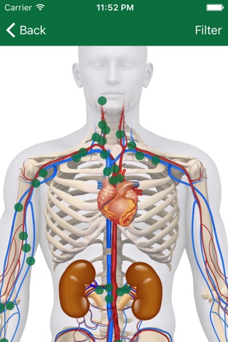 Bard PV iAnatomy screenshot 3