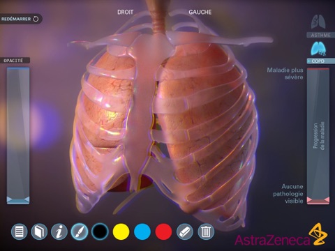 Living Lung screenshot 4