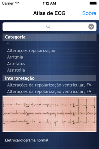 Atlas de ECG screenshot 3