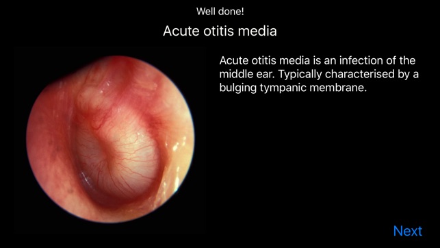 Otoscope Simulator(圖3)-速報App