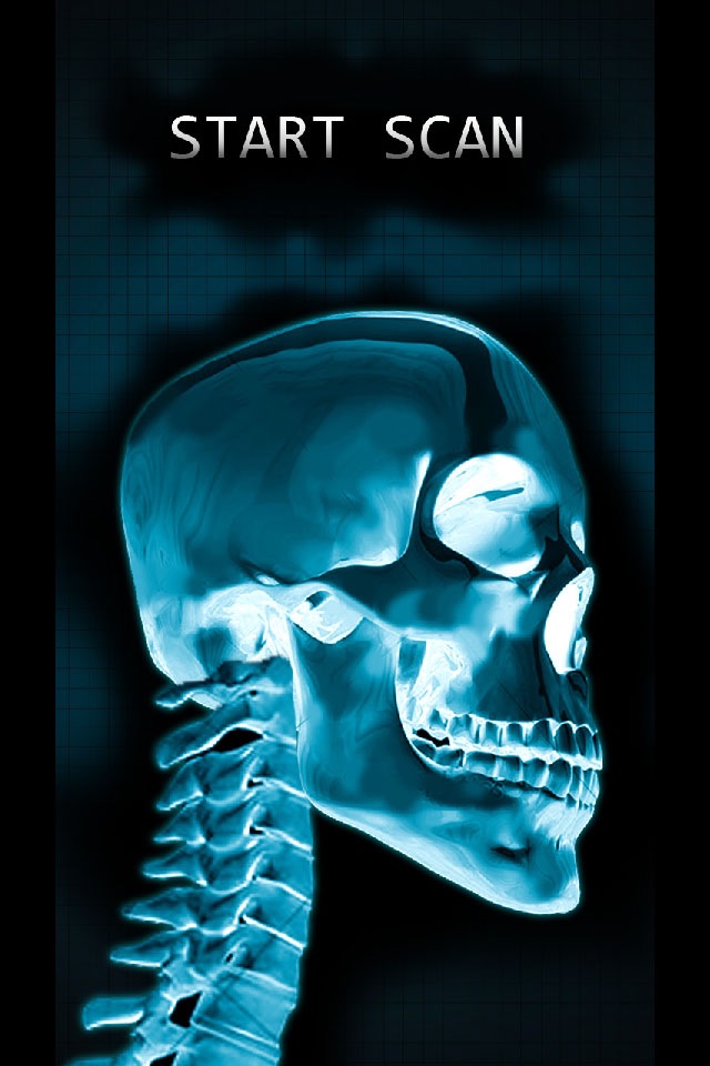 Simulator X-Ray Bone Fake screenshot 2