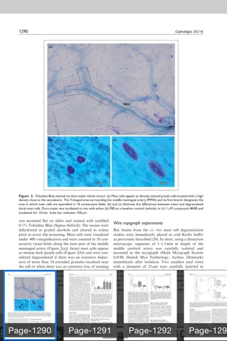 Cephalalgia – IHS screenshot 4