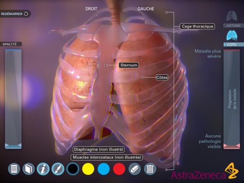 Living Lung screenshot 2