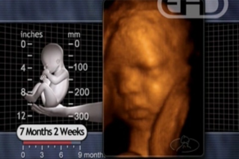 Whatcom County Pregnancy Clinic screenshot 3
