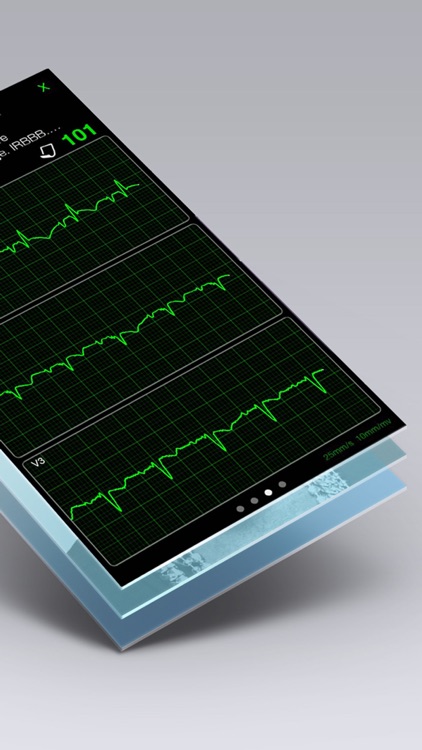 ECG Books Pro - Abnormal ECG (EKG) Case Database screenshot-4