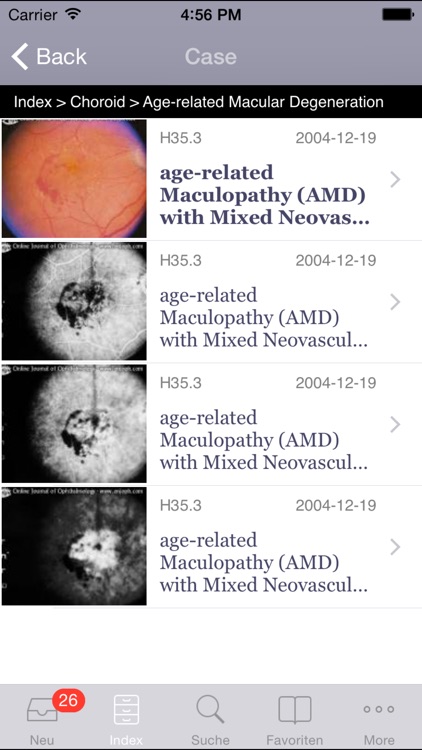 Atlas of Ophthalmology