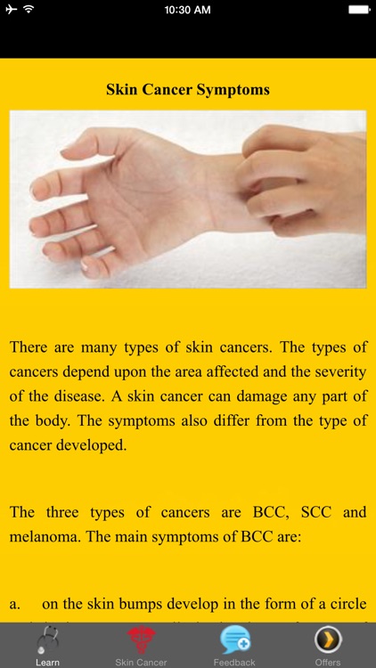 Skin Cancer Symptoms - Warning Signs