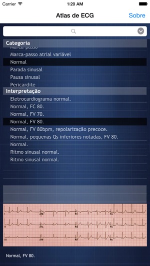 Atlas de ECG(圖1)-速報App