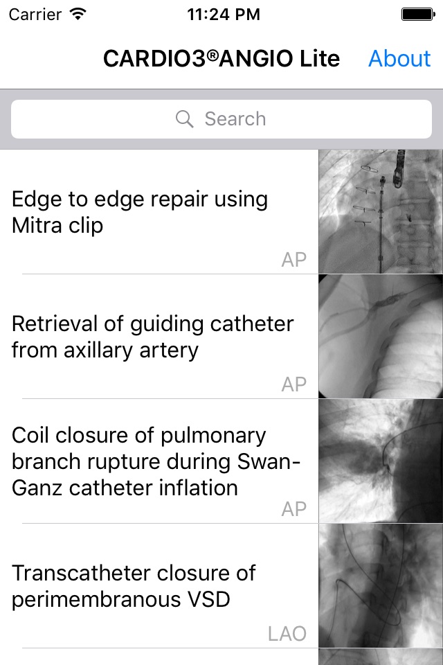 CARDIO3® Atlas of Interventional Cardiology – Lite screenshot 2