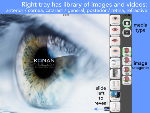 Ophthalmic Media Library screenshot 2