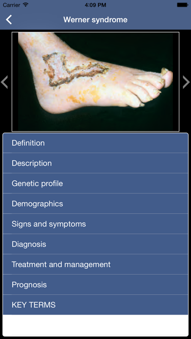 Genetic Disorders and Syndromes Pocketのおすすめ画像5