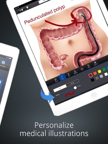 drawMD Gastroenterology - Patient Engagement by Drawing on Medical Illustrations of Gastrointestinal Anatomy for GI Specialists screenshot 2