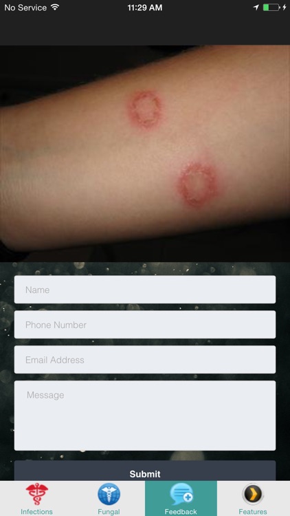 Fungal Infections - Suggested Treatment