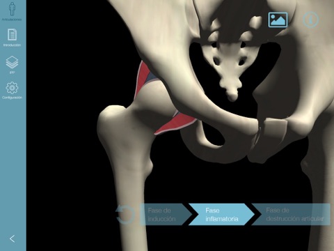 Atlas 3D de Artritis Reumatoide screenshot 4