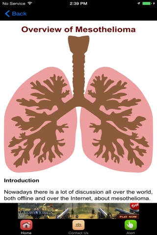 Mesothelioma Treatment & Mesothelioma Symptoms screenshot 2