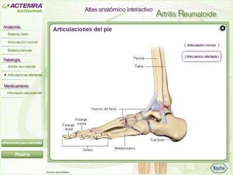 Atlas Artritis Reumatoide screenshot 3