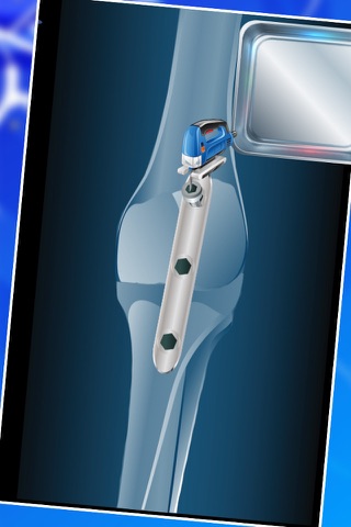 Knee Surgery – Virtual doctor & hospital game for crazy little surgeons screenshot 4