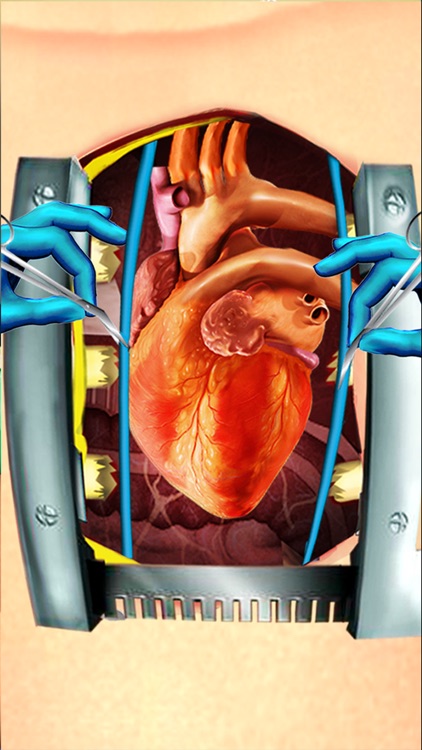 Open Heart Surgery Simulator -  Surgeon Games screenshot-4