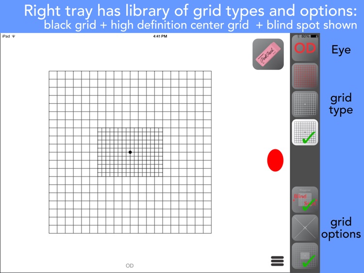 Amsler Grids