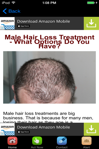 Hair Loss Treatment , Prevention and Cure screenshot 3