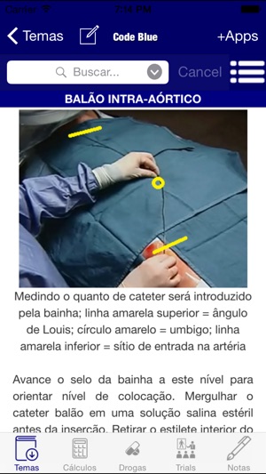 Guia de CTI - Code Blue - Medicina Intensiva, emergência, te(圖2)-速報App