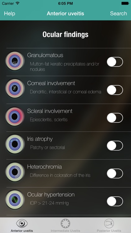 Uveitis doctor