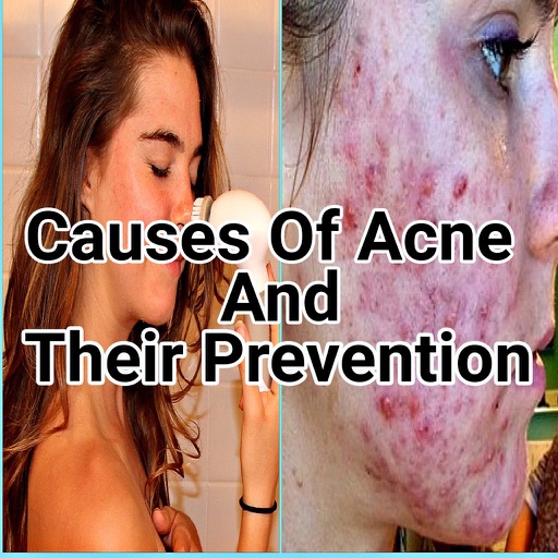 Acne prevention and treatment Free icon