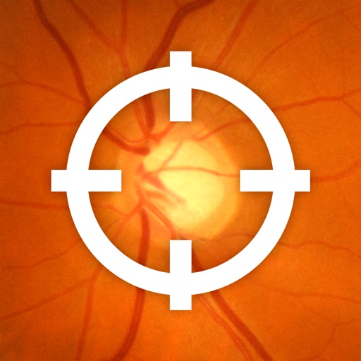 Atlas de Glaucoma para iPhone icon