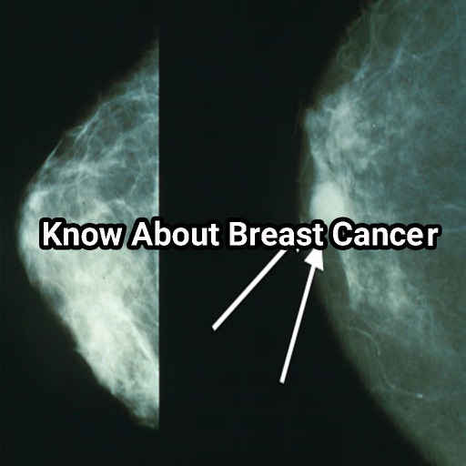 Know About Breast Cancer Free icon