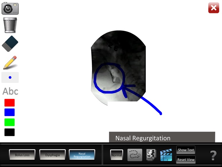 Oral Disorders screenshot-3