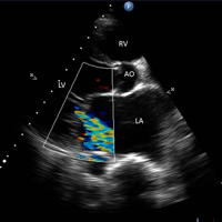 Echocardiography GlossaryCheatsheet,Study Guide