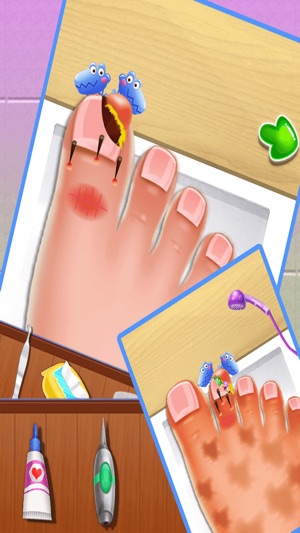 Nail doctor : Kids games toe surgery doctor games(圖3)-速報App