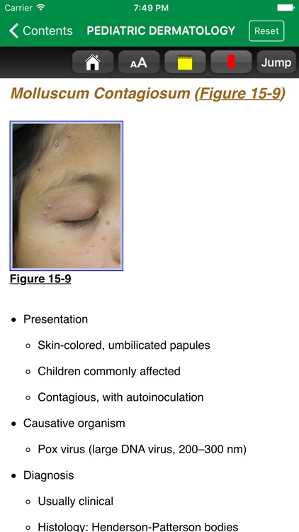 Dermatology: A Pictorial Review